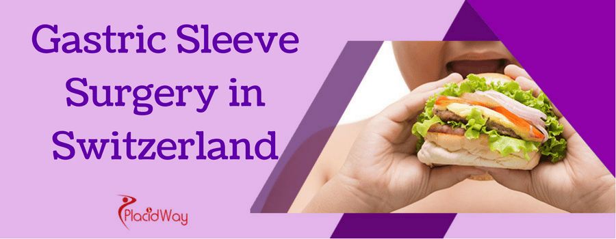 Gastric Sleeve Surgery in Switzerland